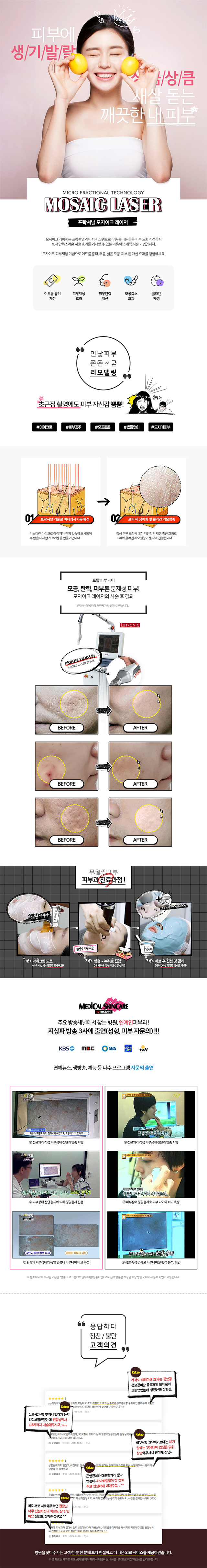 프락셔널 모자이크 레이저