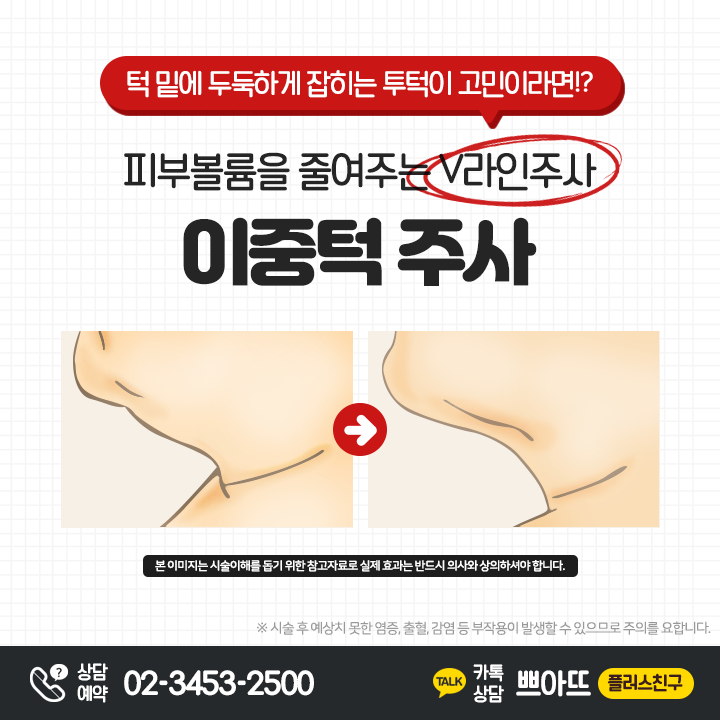 팝업 이미지 17
